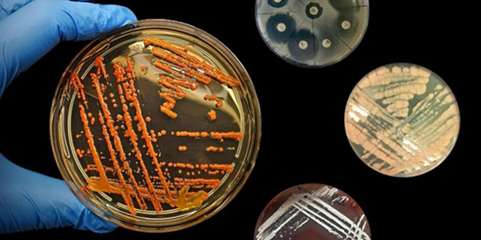 Microrganismi: alla scoperta del mondo invisibile