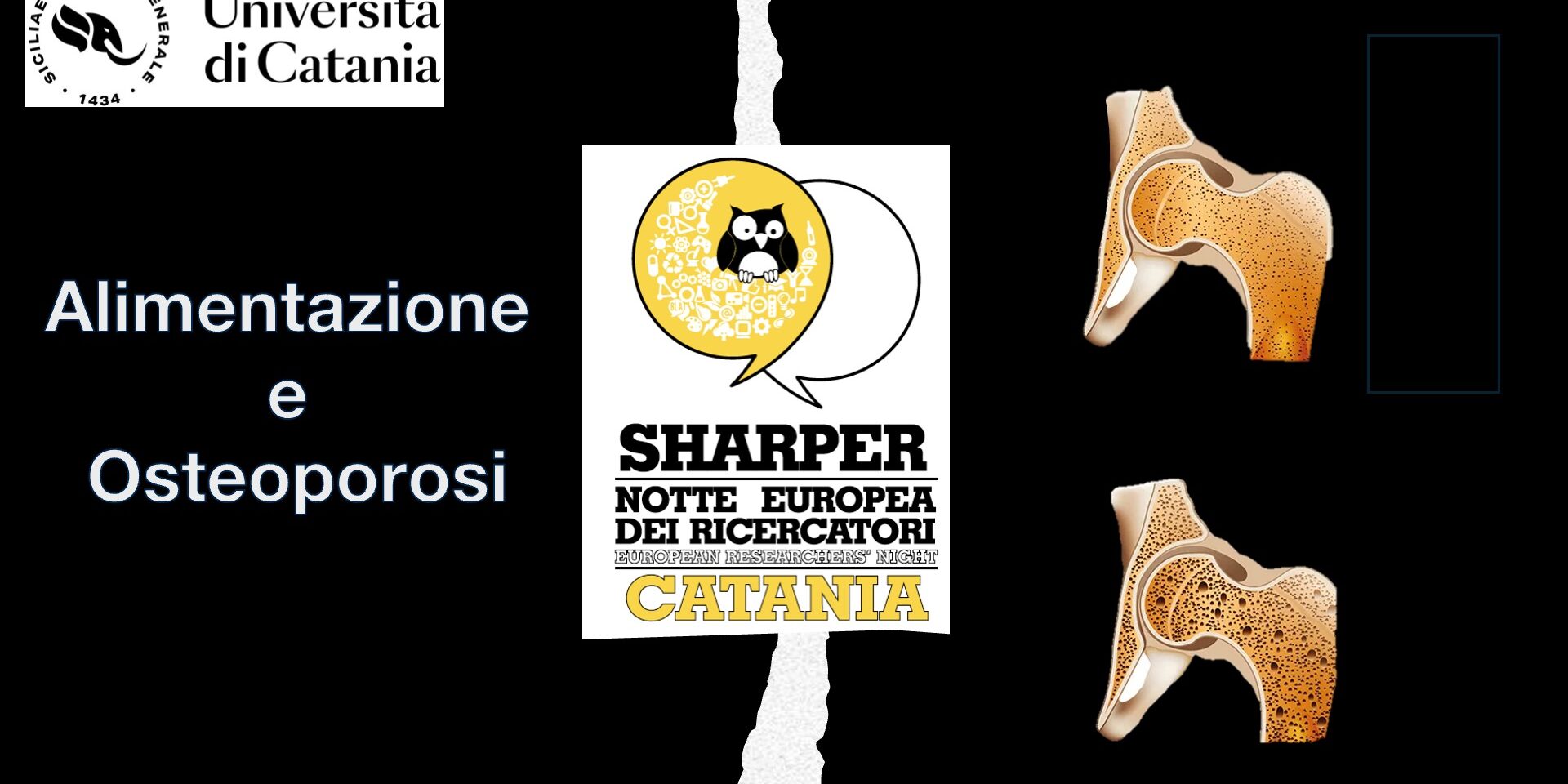 Alimentazione e osteoporosi