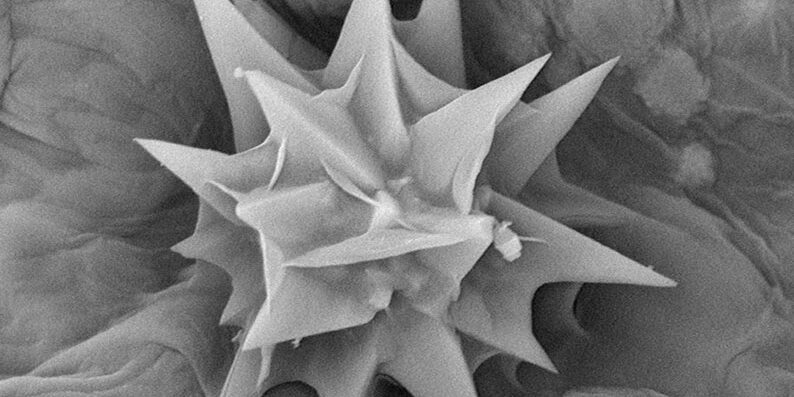 Indagini microscopiche di macroscopica rilevanza: alla scoperta della salute dell’ambiente e degli alimenti