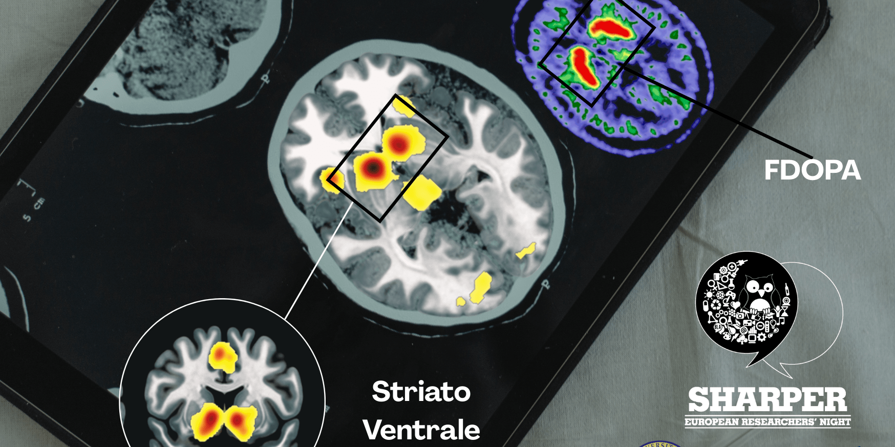 Le Vie della Ricompensa: un viaggio nel cervello