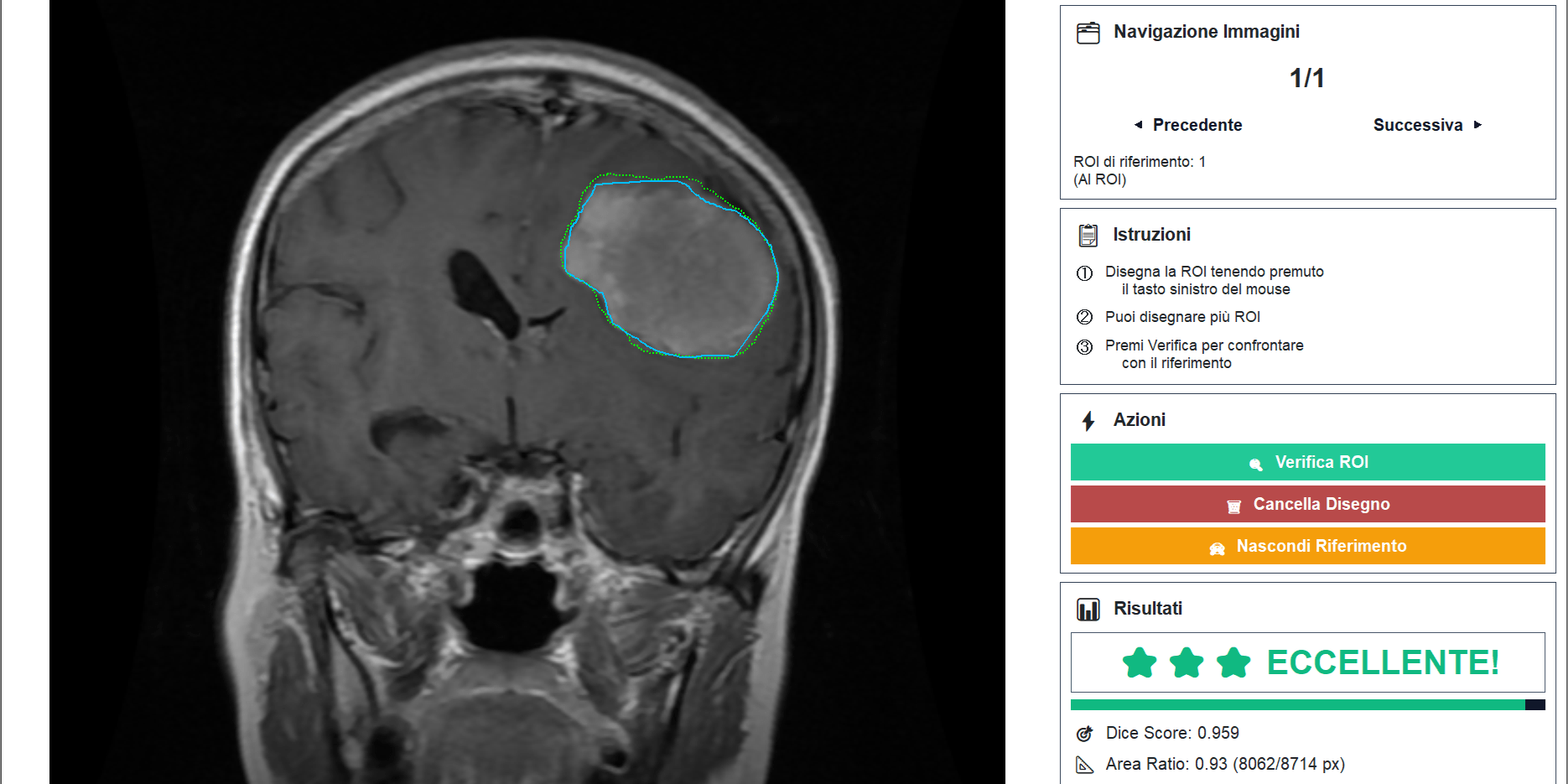 L’Intelligenza Artificiale che impara dai medici