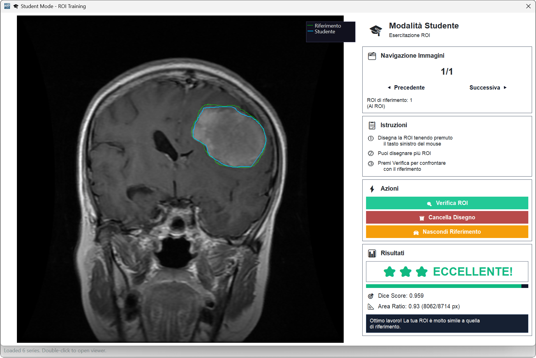 L’Intelligenza Artificiale che impara dai medici